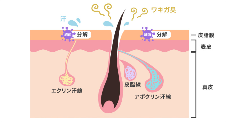 脇汗のニオイの原因はエクリン腺とアポクリン腺